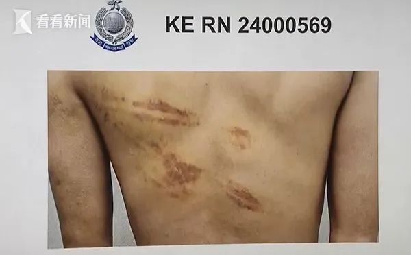 » 被禁锢缅甸25岁香港人带伤返回  警方不谈是否交赎金1月16日，香港特别行政区保安局发布消息，一名在东南亚被禁锢港人当天已安全返回香港