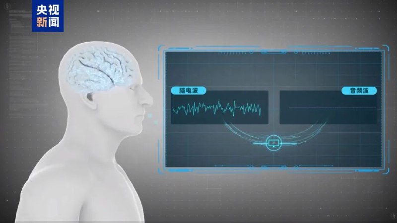 » 3. 国家医保局为脑机接口医疗服务价格单独立项今天，国家医保局发布《神经系统医疗服务价格项目立项指南》，其中专门为脑机接口新技术单独立项，设立了侵入式脑机接口植入费、取出费，非侵入式脑机接口适配费等价格项目，这意味着，一旦脑机接口技术成熟，快速进入临床应用的收费路径已经铺好